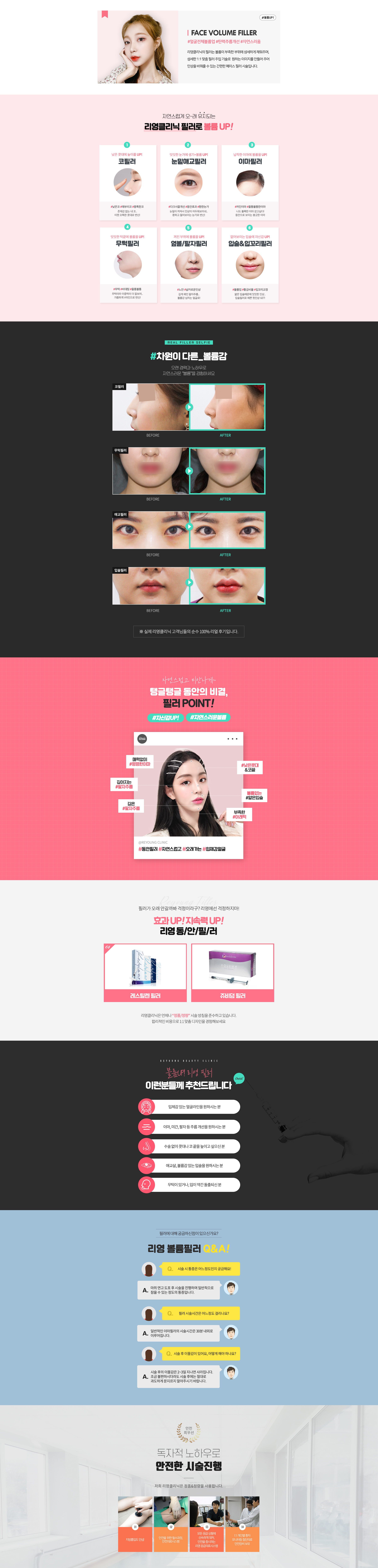자연스럽게 오~래 유지되는 리영클리닉 필러로 볼륨UP!