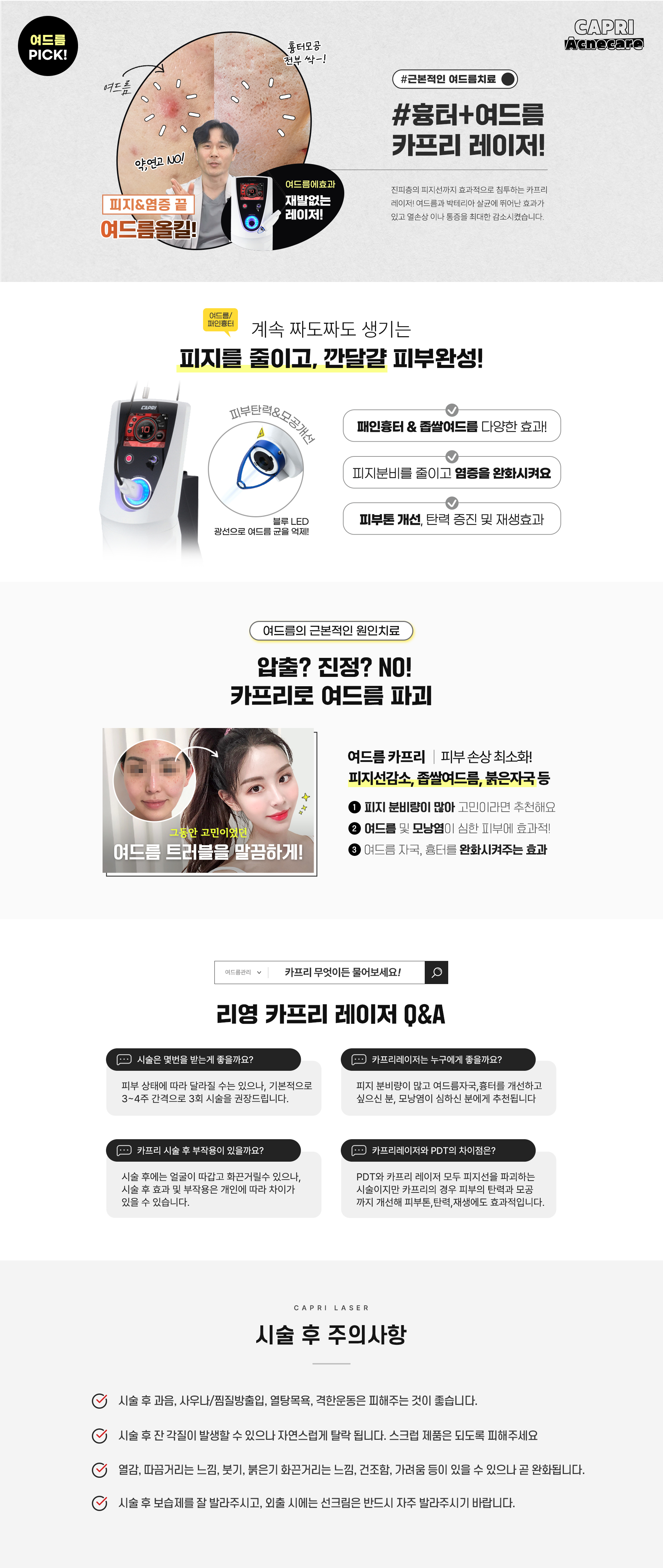근본적인 여드름치료! 흉터+여드름 카프리 레이저!