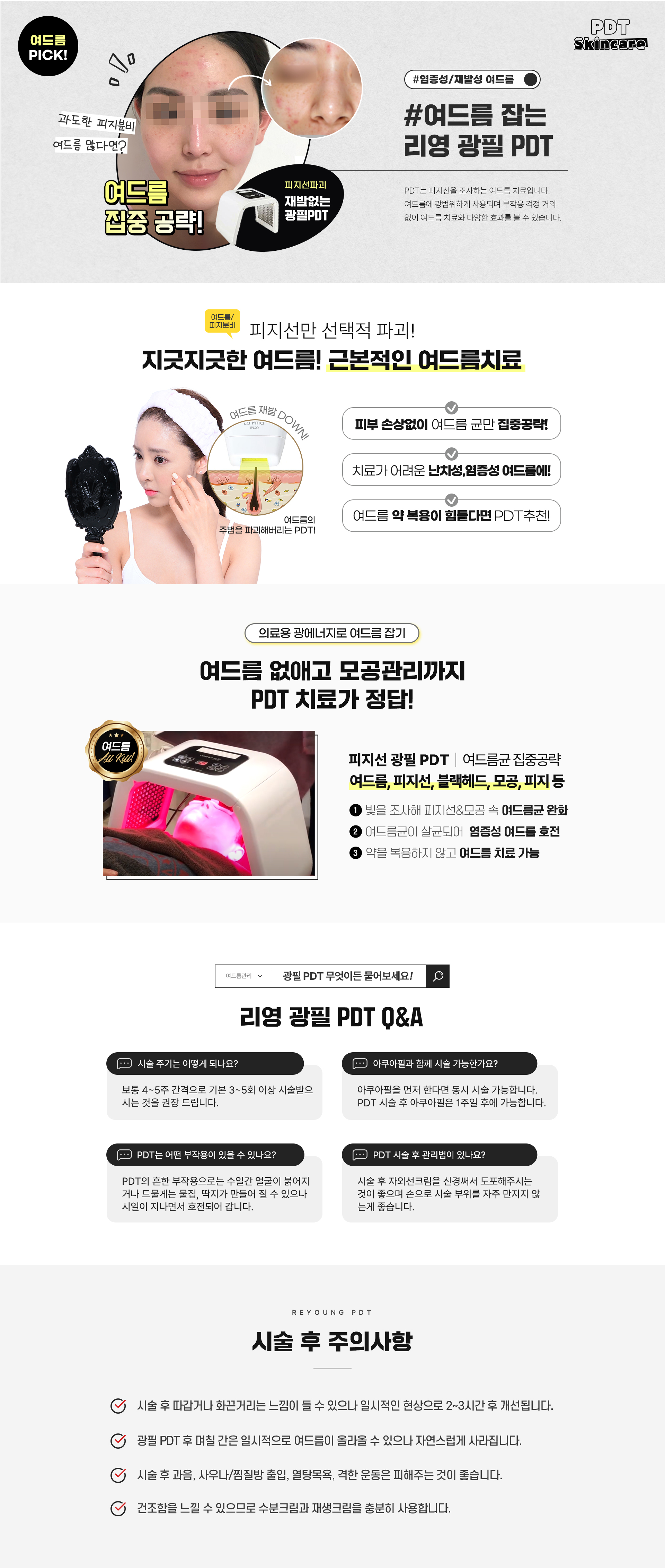 염증성/재발성 여드름! 여드름 잡는 리영 광필 PDT